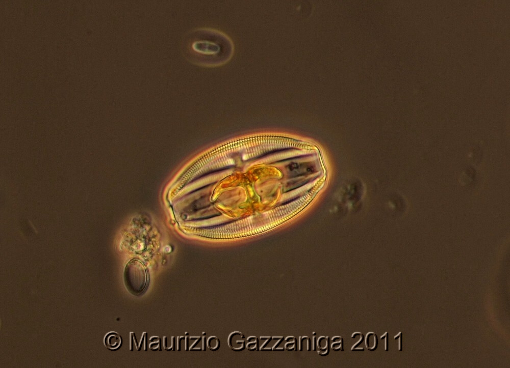 Amphora  sp - Contrasto di fase